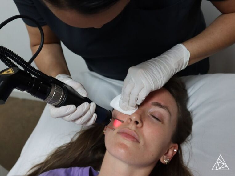Marketing Your Aesthetic Laser Business in 2024